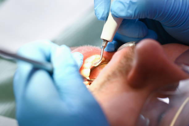 Best Pediatric Emergency Dentist in Stratford, CA