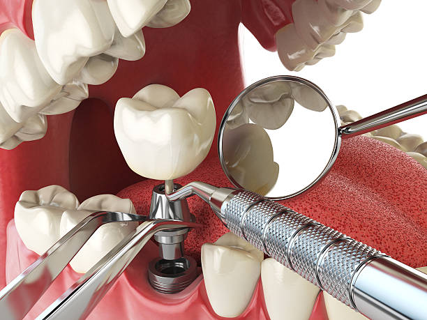 Best Emergency Cosmetic Dentistry in Stratford, CA